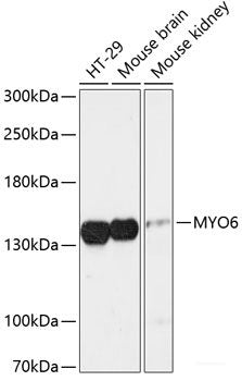 Immunofluorescence analysis of NIH-3T3 cells using UMPS Polyclonal Antibody at dilution of 1:100 (40x lens). Blue: DAPI for nuclear staining.