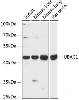 Western blot analysis of extracts of various cell lines using CST3 Polyclonal Antibody at dilution of 1:1000.