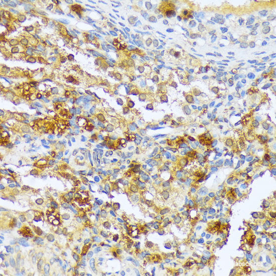 Immunofluorescence analysis of A549 cells using EPHA1 Polyclonal Antibody