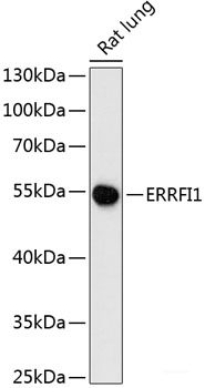 Immunohistochemistry of paraffin-embedded Human breast cancer using CD168 Polyclonal Antibody at dilution of 1:100 (40x lens).