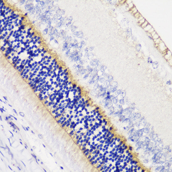 Immunofluorescence analysis of A-549 cells using MB Polyclonal Antibody