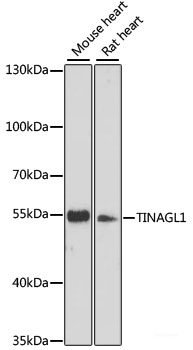 Western blot analysis of extracts of various cell lines using PLEK Polyclonal Antibody at dilution of 1:1000.
