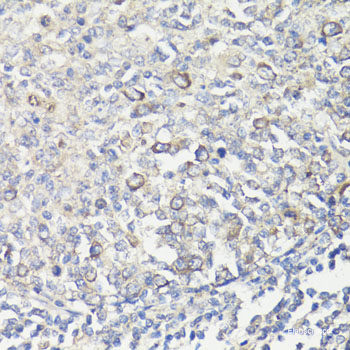 Immunofluorescence analysis of A549 cells using SRGN Polyclonal Antibody