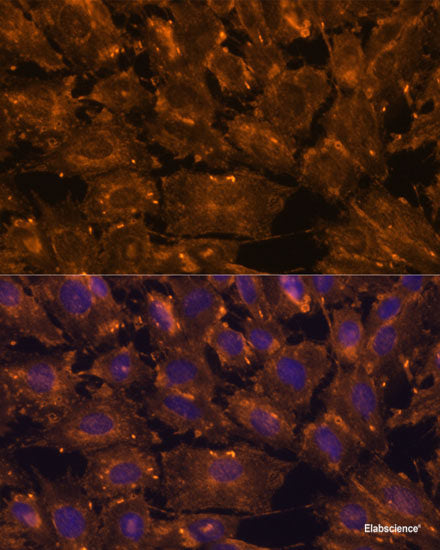 Western blot analysis of extracts of various cell lines using RRM1 Polyclonal Antibody at dilution of 1:1000.