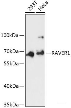 Immunofluorescence analysis of MCF-7 cells using RTKN Polyclonal Antibody