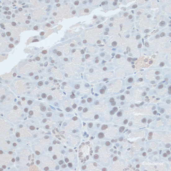 Immunofluorescence analysis of A549 cells using TDG Polyclonal Antibody