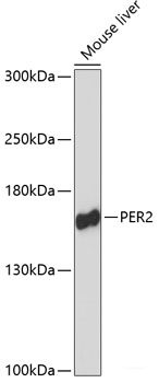 Immunohistochemistry of paraffin-embedded Rat heart using VCP Polyclonal Antibody at dilution of 1:200 (40x lens).