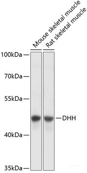 Western blot analysis of extracts of Mouse spleen using SSNA1 Polyclonal Antibody at dilution of 1:1000.