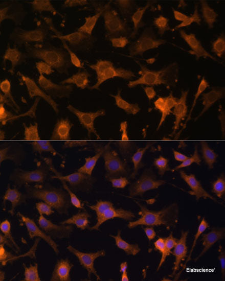 Immunofluorescence analysis of A549 cells using STK19 Polyclonal Antibody