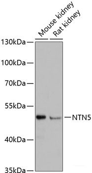 Immunohistochemistry of paraffin-embedded Mouse brain using USP10 Polyclonal Antibody at dilution of 1:100 (40x lens).