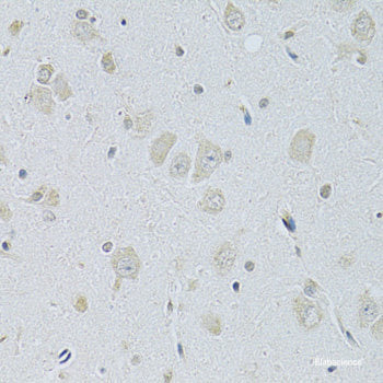 Immunofluorescence analysis of U2OS cells using pum1 Polyclonal Antibody at dilution of 1:100. Blue: DAPI for nuclear staining.