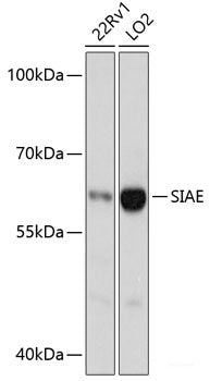 Immunohistochemistry of paraffin-embedded Rat liver using UBD Polyclonal Antibody at dilution of 1:200 (40x lens).