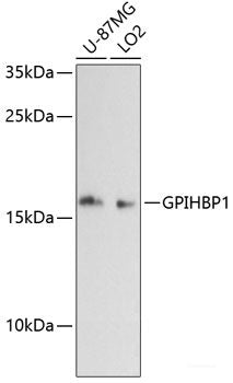 Immunohistochemistry of paraffin-embedded Human prostate cancer using TARDBP Polyclonal Antibody at dilution of 1:100 (40x lens).