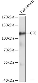 Immunofluorescence analysis of H9C2 cells using RIG-I / DDX58 Polyclonal Antibody at dilution of 1:100. Blue: DAPI for nuclear staining.