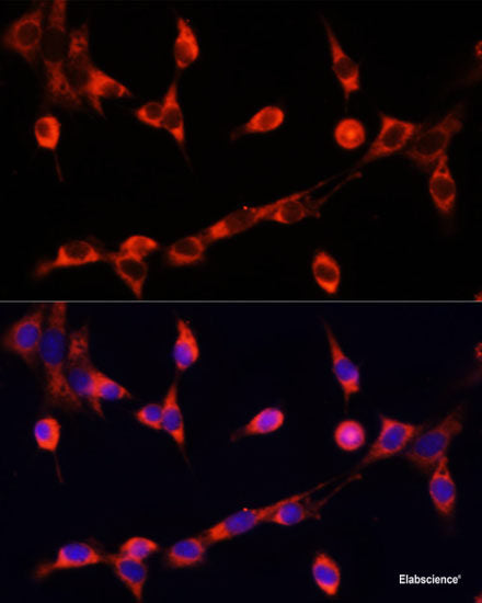 Immunofluorescence analysis of HeLa cells using SMPX Polyclonal Antibody