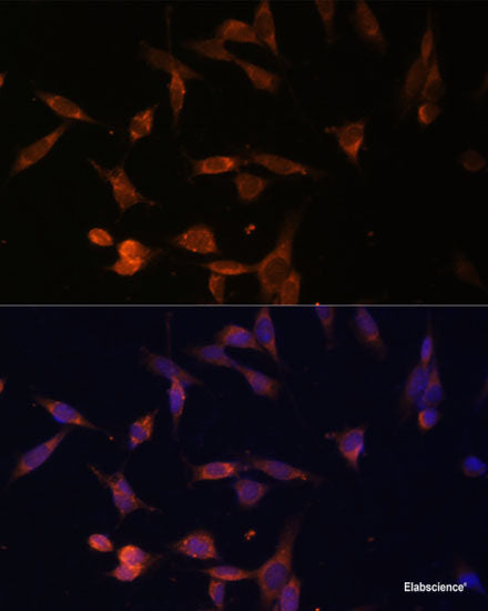 Immunofluorescence analysis of A549 cells using VPS4A Polyclonal Antibody