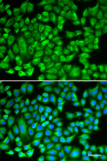 Immunofluorescence analysis of A549 cells using KLF15 Polyclonal Antibody