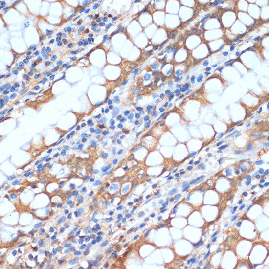 Immunohistochemistry of paraffin-embedded Human stomach using UBIAD1 Polyclonal Antibody at dilution of 1:100 (40x lens).