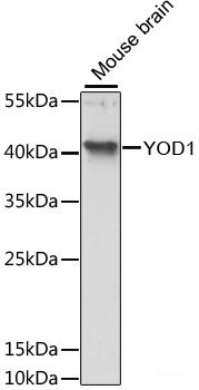 Western blot analysis of extracts of HepG2 cells using CXXC1 Polyclonal Antibody at dilution of 1:1000.