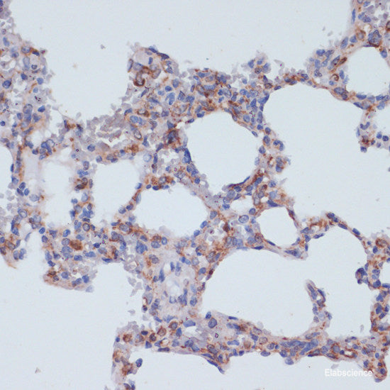 Immunofluorescence analysis of A549 cells using CAMK1D Polyclonal Antibody