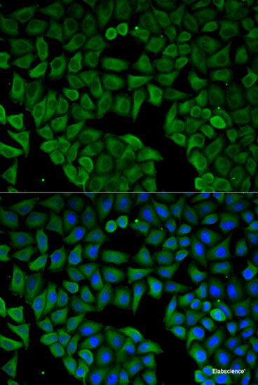 Immunofluorescence analysis of A549 cells using MTUS1 Polyclonal Antibody