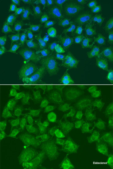 Immunofluorescence analysis of A549 cells using SETD6 Polyclonal Antibody