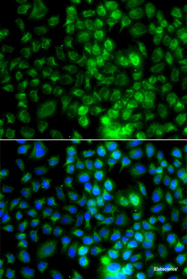 Immunohistochemistry of paraffin-embedded Rat kidney using ACY1 Polyclonal Antibody at dilution of 1:100 (40x lens).