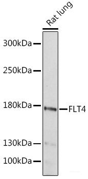 Immunohistochemistry of paraffin-embedded Human liver using HO-1 Polyclonal Antibody at dilution of 1:200 (40x lens).