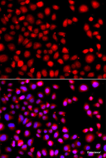 Immunofluorescence analysis of HeLa cells using AMPD3 Polyclonal Antibody