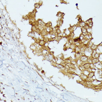 Immunofluorescence analysis of HeLa cells using ANXA4 Polyclonal Antibody