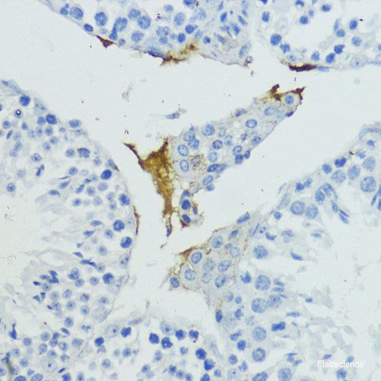 Immunohistochemistry of paraffin-embedded Rat liver using BCL2L2 Polyclonal Antibody at dilution of 1:100 (40x lens).