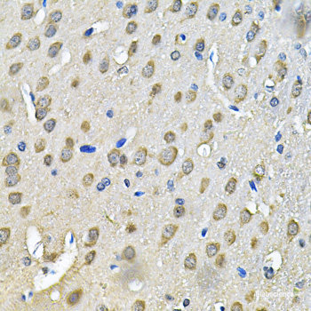 Immunofluorescence analysis of A549 cells using GADD45A Polyclonal Antibody