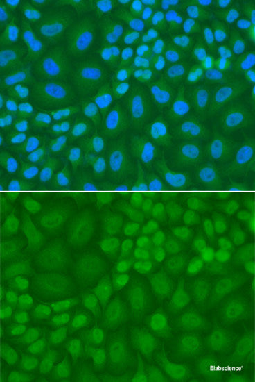 Immunohistochemistry of paraffin-embedded Human kidney using LCP1 Polyclonal Antibody at dilution of 1:100 (40x lens).