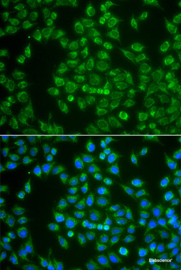 Western blot analysis of extracts of various cell lines using LYZ Polyclonal Antibody at dilution of 1:3000.