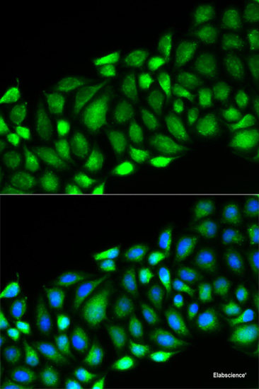 Immunofluorescence analysis of U2OS cells using NDUFS4 Polyclonal Antibody