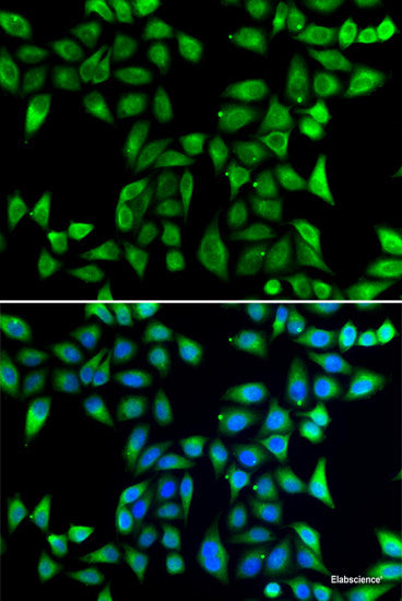 Immunohistochemistry of paraffin-embedded Human stomach using POU2F1 Polyclonal Antibody at dilution of 1:100 (40x lens).