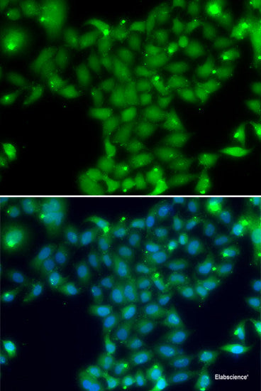 Western blot analysis of extracts of various cell lines using PPP4C Polyclonal Antibody at dilution of 1:1000.