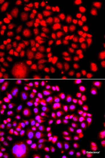 Western blot analysis of extracts of various cell lines using PSMC5 Polyclonal Antibody at dilution of 1:1000.