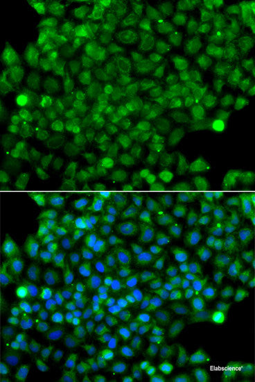 Immunofluorescence analysis of MCF-7 cells using RAB4A Polyclonal Antibody