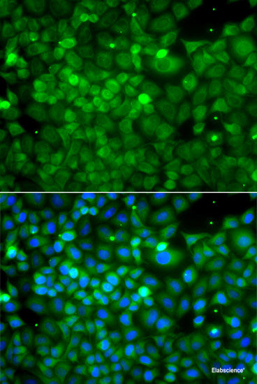Immunohistochemistry of paraffin-embedded Rat brain using TKT Polyclonal Antibody at dilution of 1:100 (40x lens).