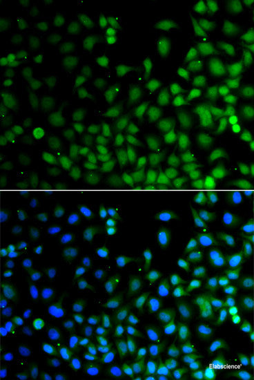 Immunohistochemistry of paraffin-embedded Rat kidney using TNFRSF1B Polyclonal Antibody at dilution of 1:200 (40x lens).