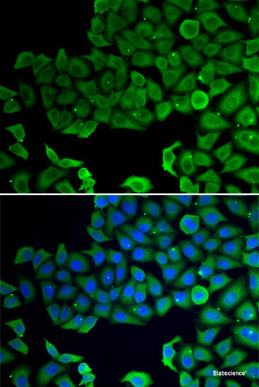 Immunofluorescence analysis of U2OS cells using UBE2I Polyclonal Antibody