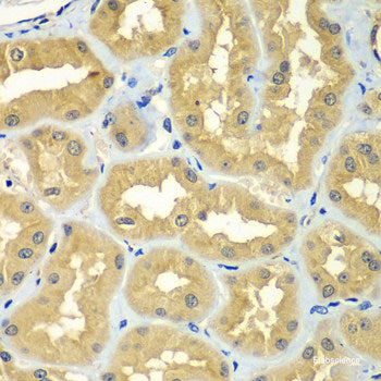 Immunohistochemistry of paraffin-embedded Rat brain using Eif2ak2 Polyclonal Antibody at dilution of 1:200 (40x lens).