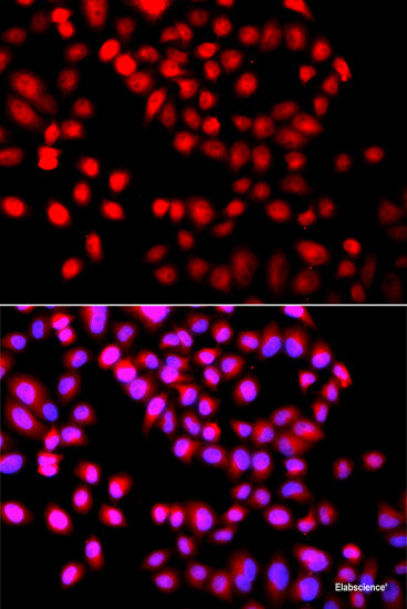 Immunofluorescence analysis of MCF-7 cells using RAD54L2 Polyclonal Antibody