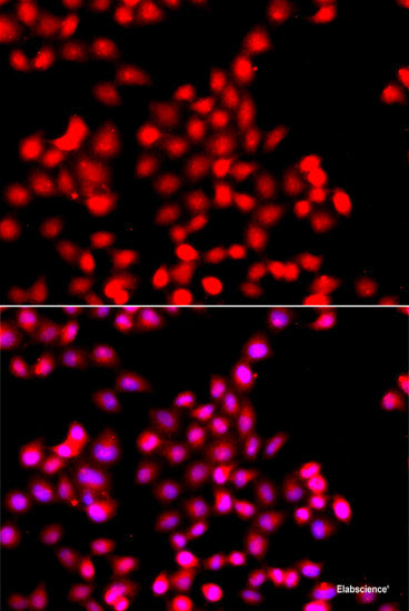 Immunofluorescence analysis of HeLa cells using LSM4 Polyclonal Antibody at dilution of 1:50. Blue: DAPI for nuclear staining.