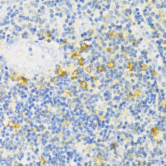 Immunofluorescence analysis of HeLa cells using P4HTM Polyclonal Antibody