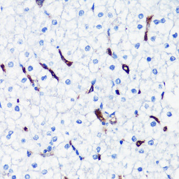 Immunofluorescence analysis of MCF-7 cells using RFFL Polyclonal Antibody