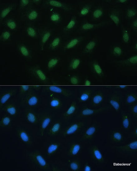 Immunofluorescence analysis of HeLa cells using MSMB Polyclonal Antibody