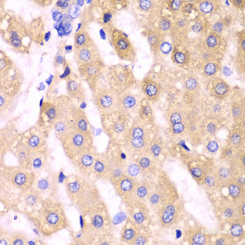 Immunofluorescence analysis of A549 cells using XRCC2 Polyclonal Antibody