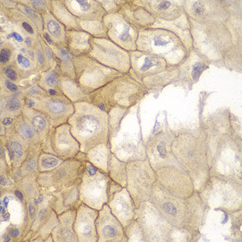 Immunofluorescence analysis of HeLa cells using MECOM Polyclonal Antibody
